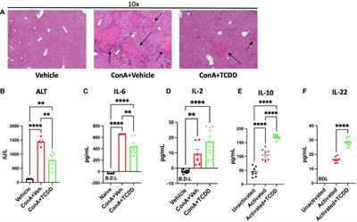 AhR Activation Leads to Attenuation of Murine Autoimmune Hepatitis: Single-Cell RNA-Seq Analysis Reveals Unique Immune Cell Phenotypes and Gene Expression Changes in the Liver